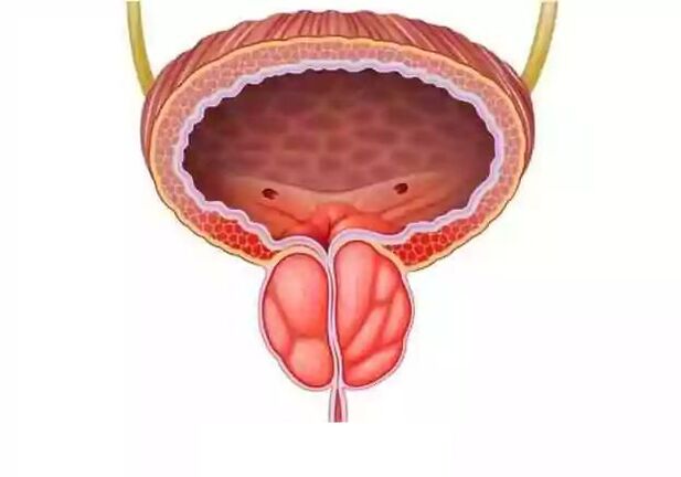 vyrų prostatito gydymas